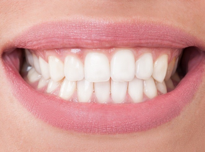 Close up of smile with long lower teeth