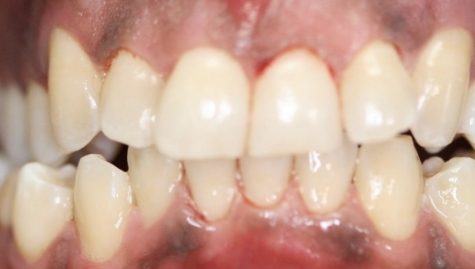 Close up of flawless smile after cosmetic dentistry