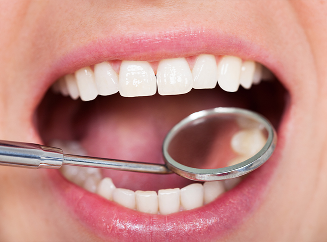 Close up of dental mirror inside of mouth