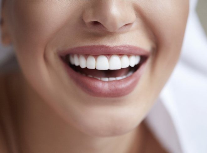 Close up of smile with straight white teeth and even gumline