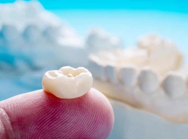 Person holding a dental crown on their finger