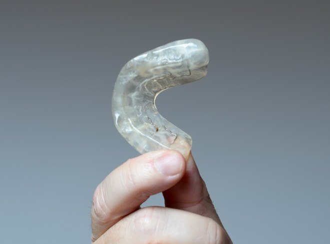 Hand holding a white nightguard for bruxism