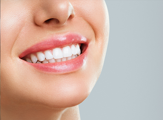 Close up of smile with straight white teeth