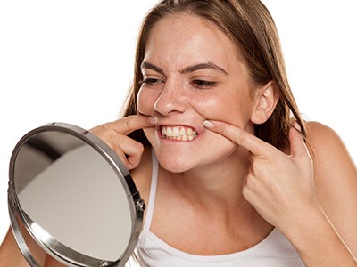 Houston patient with stained teeth before whitening