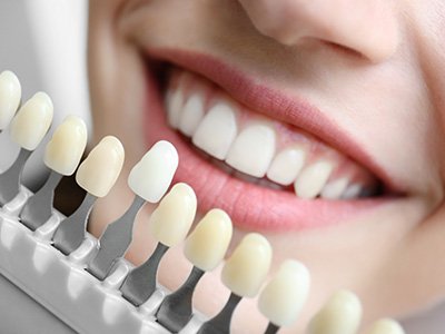 Smiling Houston patient after whitening treatment
