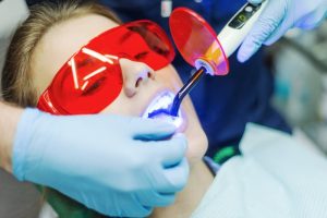 A woman receiving teeth whitening treatment.