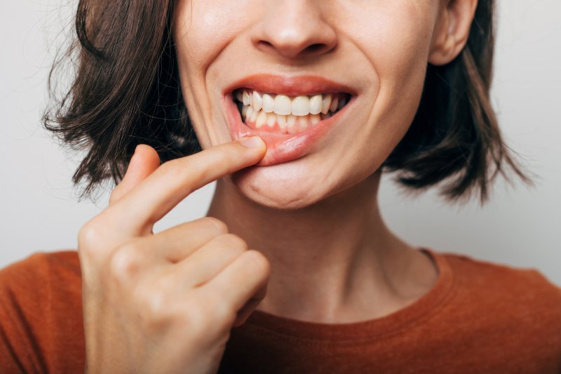 Woman shows off gums