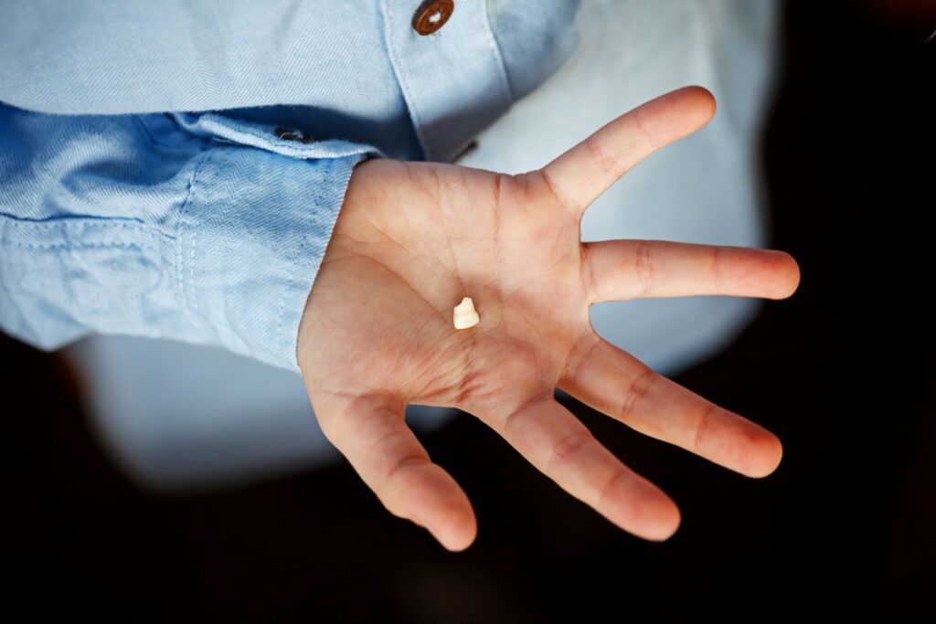 Bird's eye view of broken tooth in palm of someone's hand